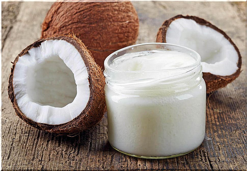 Coconut Oil Can Help Alleviate Scalp Psoriasis Symptoms