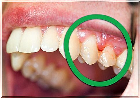 periodontal infection can cause toothache