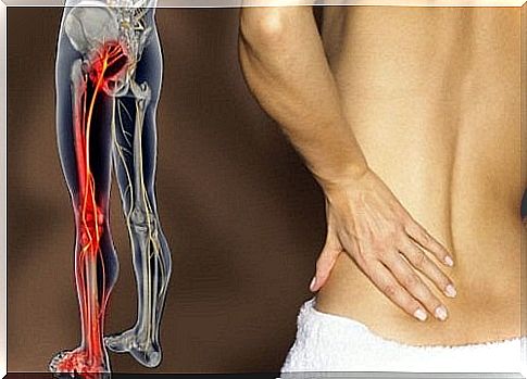 How to relieve sciatic nerve pain with exercise