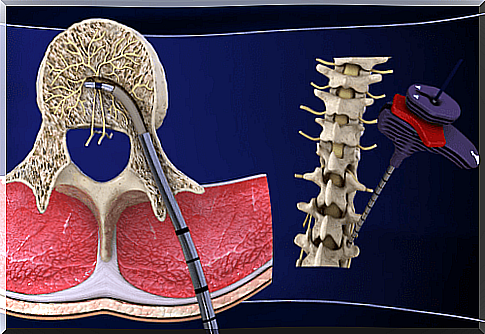 Discover the new treatment for chronic low back pain