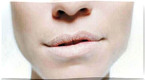 Dry lips are a sign of dehydration