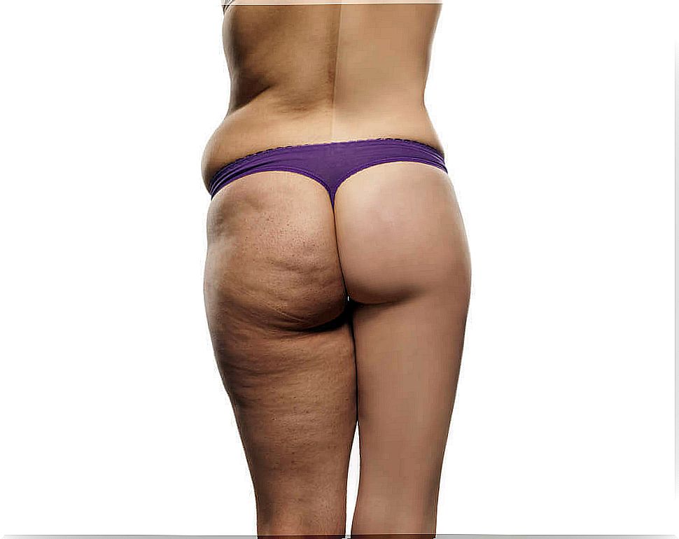 How to go on a diet to reduce cellulite