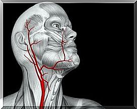 Moyamoya disease