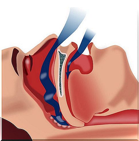 Natural Treatment for Sleep Apnea